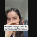 The ordinary niacinamida